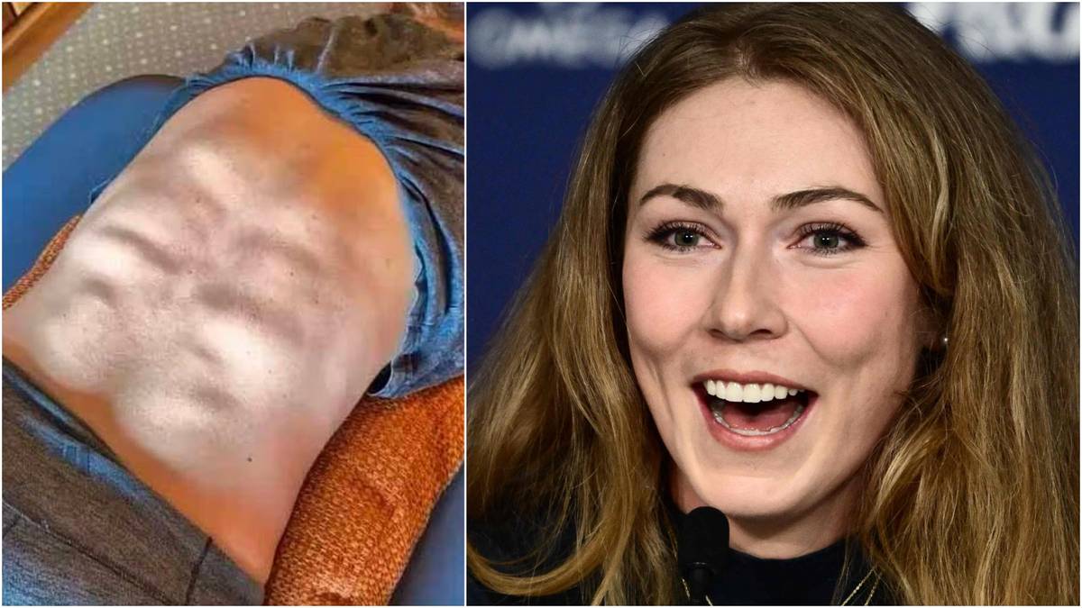 OL-stjernen ble satt ut av egen kropp: – Visste ikke at den så slik ut