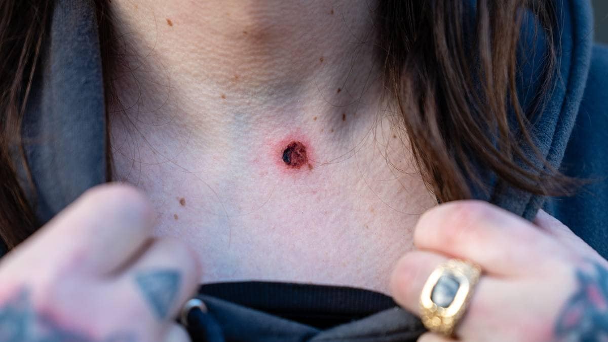 Mann ble skutt med luftvåpen i en pengekrangel