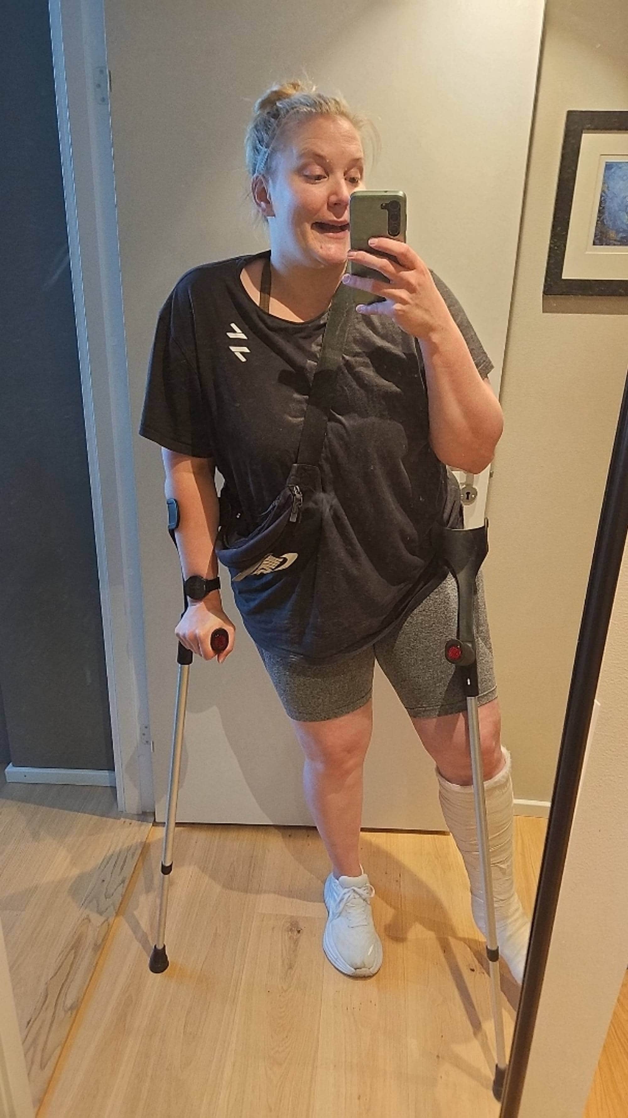 Dame med krykker og gips
