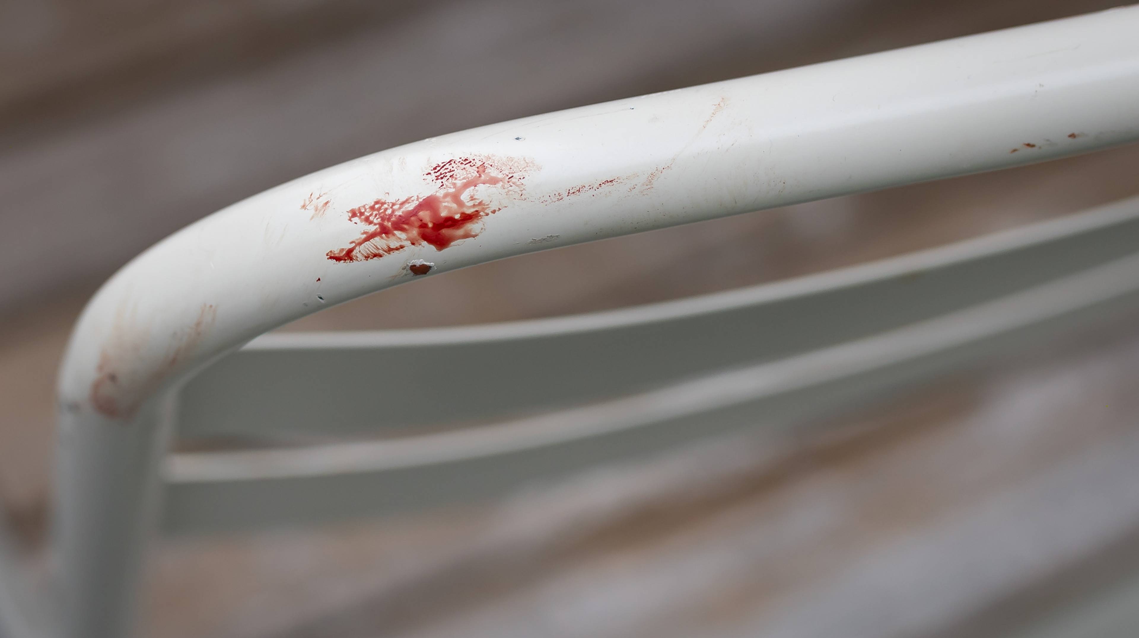Blodflekker på en hvit metalloverflate, sannsynligvis en stol eller et gjerde. (Bildebeskrivelsen er laget av en KI-tjeneste)