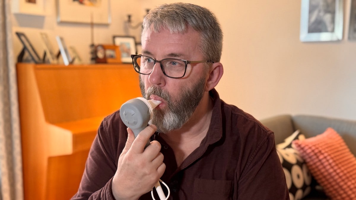 Knut hadde sterke hovud­smerter i tolv år før han fekk diagnosen: – Tortur!