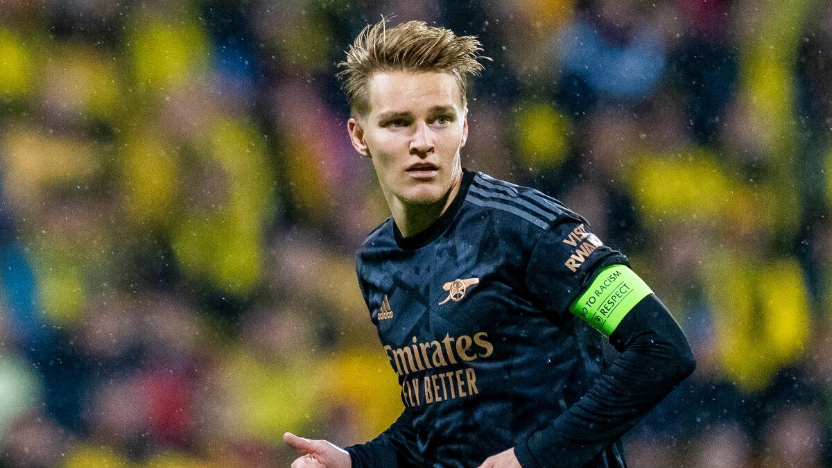 Arsenal-manager Arteta med Ødegaard-oppdatering – mister ny kamp med skade