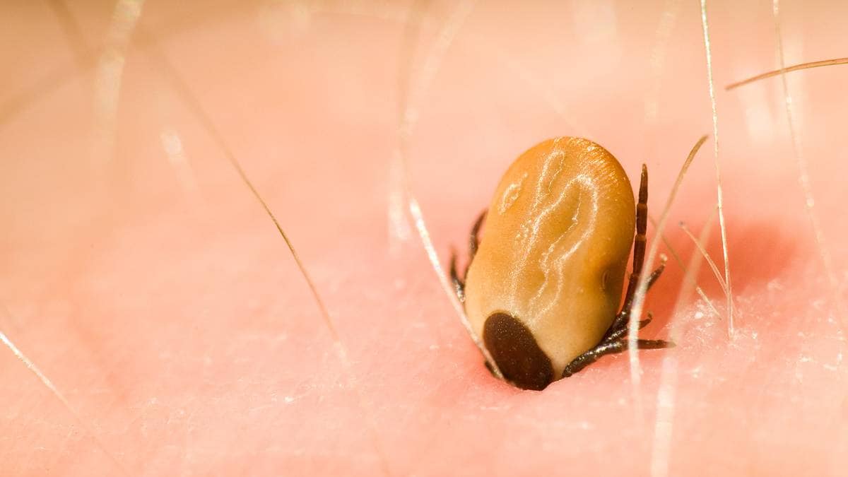 Mye borreliose og TBE i Agder