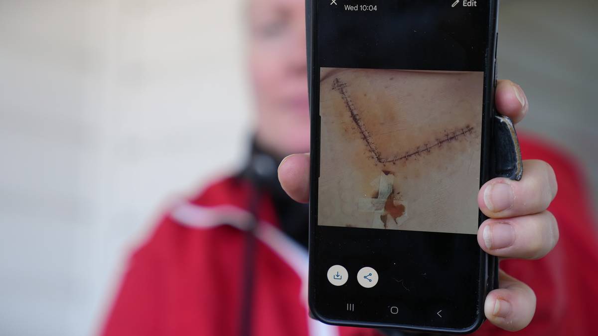 Operert av kirurg som granskes: – Jeg trodde jeg skulle stryke med
