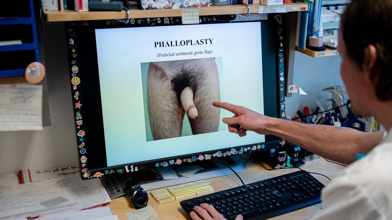 Klinikksjef Kim Alexander Tønseth viser fram flere ulike operasjoner folk har behov for.