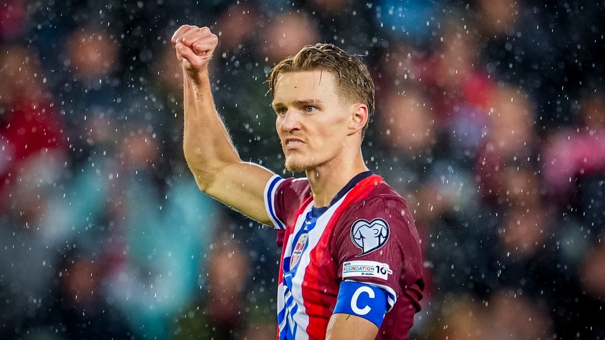 Ordknapp om Ødegaard-skade: – Gjør veldig vondt