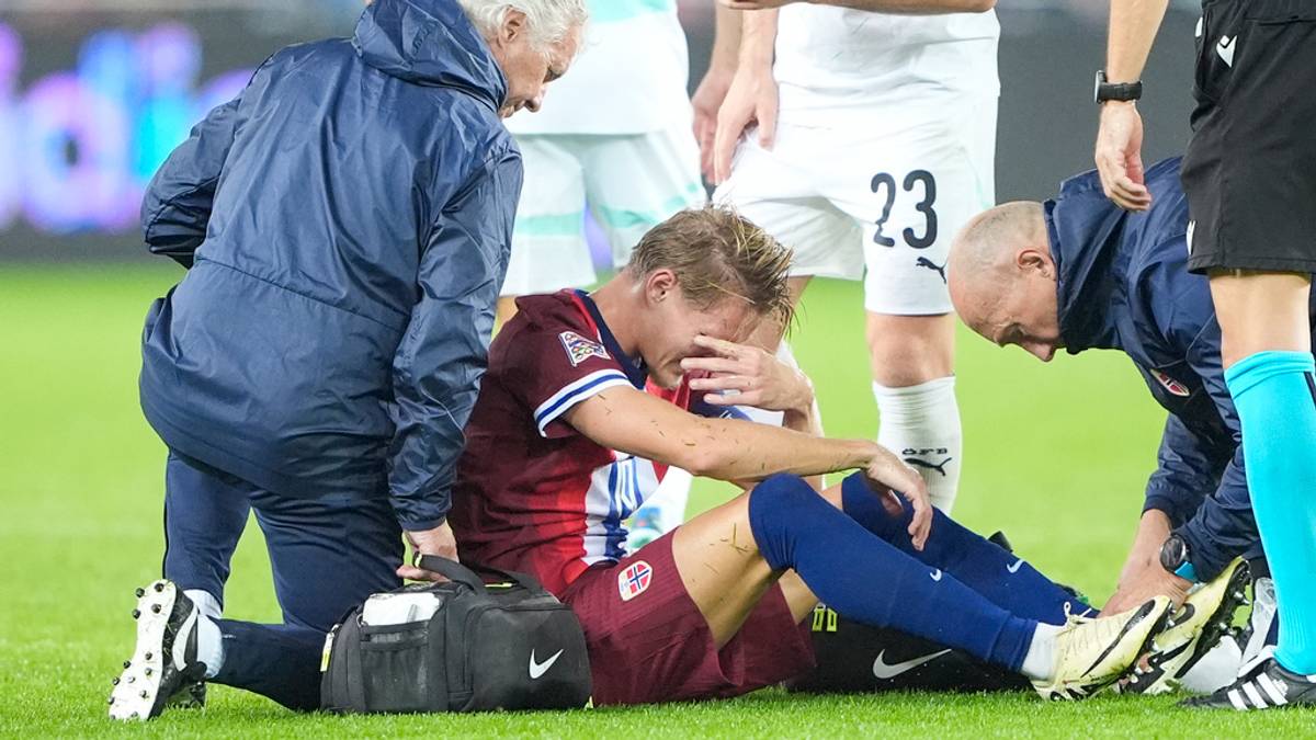 Ødegaard ikke utelukket mot Tottenham