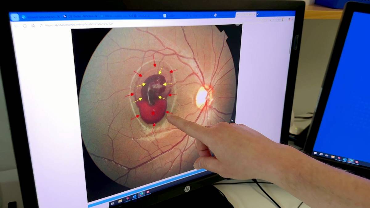Etterforsker hendelse der russ ble delvis blind av laser