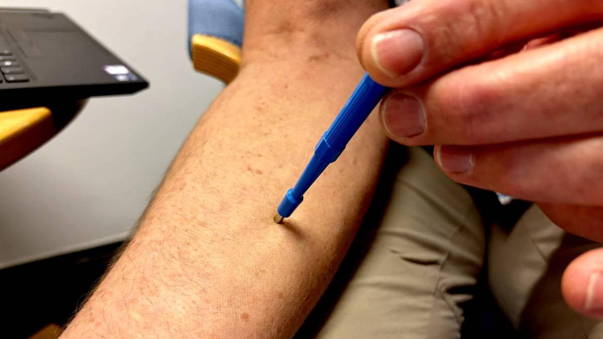Har funnet ni superdonorer som skal kunne kurere tusenvis