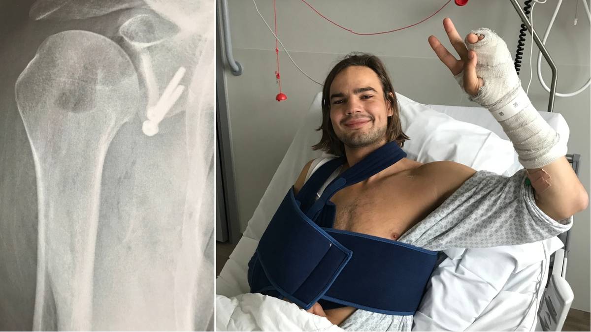 Marerittstart for ny programleiar: Skadde skuldra rett før premieren