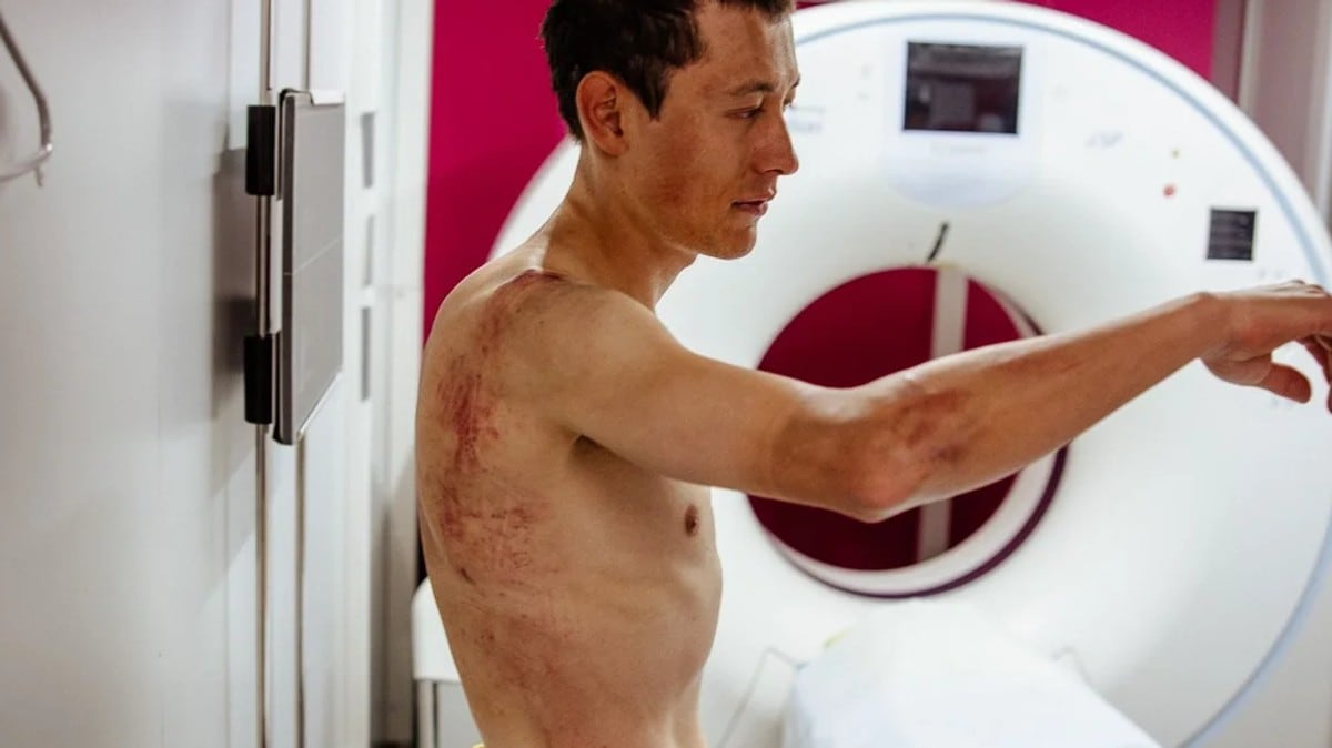 Træen bryter Tour de France etter stygg velt: – Kunne ikke fortsette