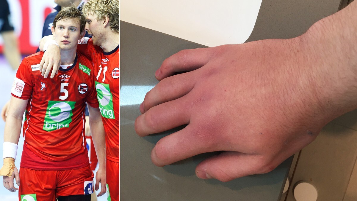 Sagosen Avslorer Hemmelig Skade Spilte Med Brukket Hand Nrk Sport Sportsnyheter Resultater Og Sendeplan