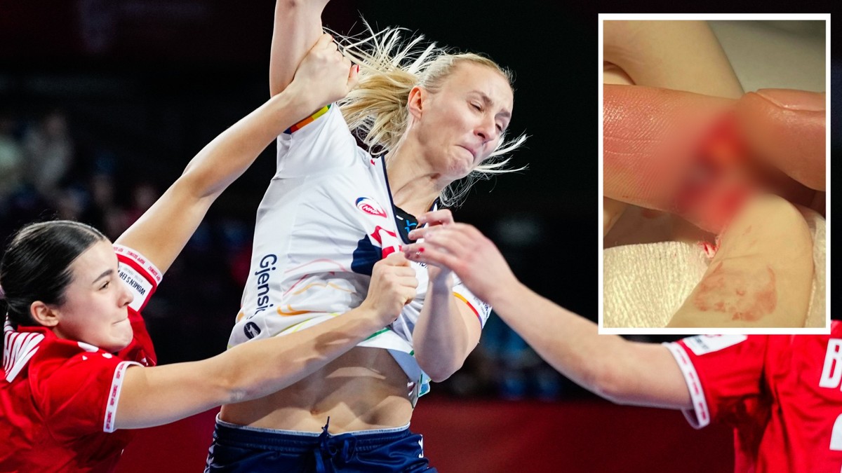 Negler skaper trøbbel – tek grep etter groteske skadar