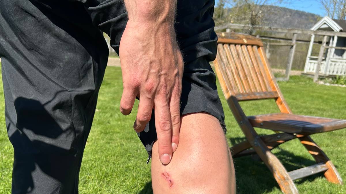 Blodig alvor for Noreg sitt EM-håp: Angrepet av hund på trening i USA