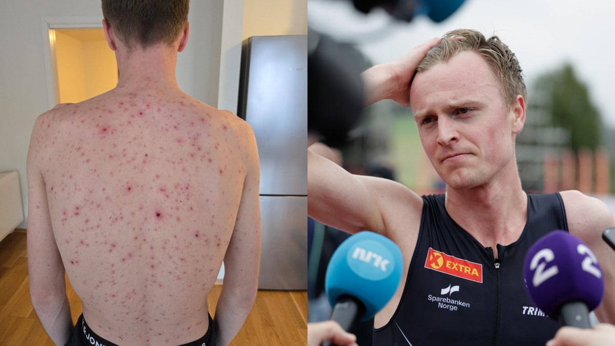 Nordås avslører marerittstart på året: – Kan ikke huske å ha vært så syk