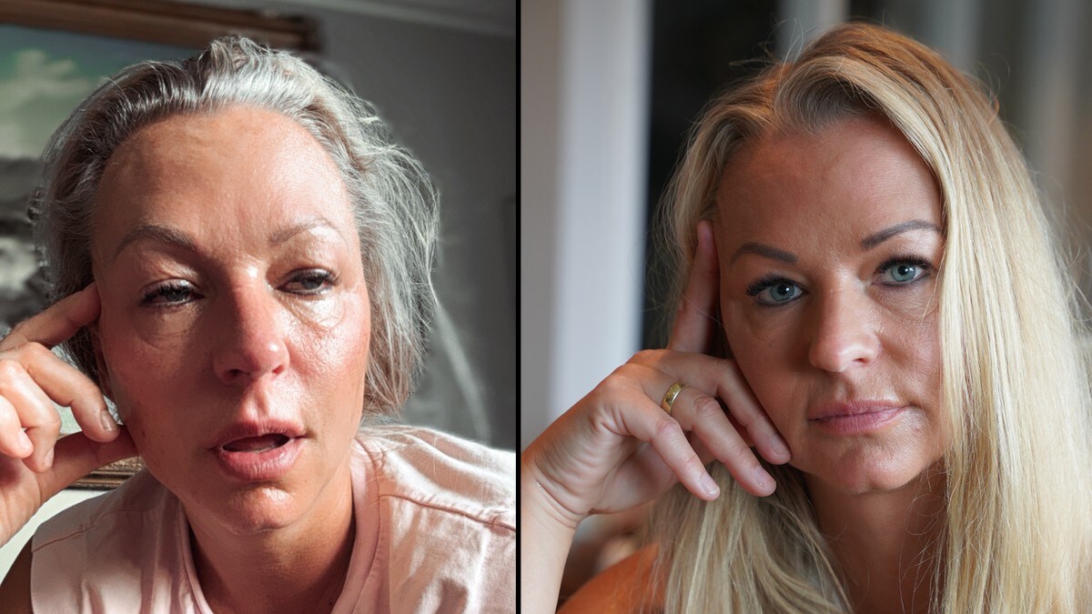 Advarer om sykdommen: – Hoster til jeg besvimer