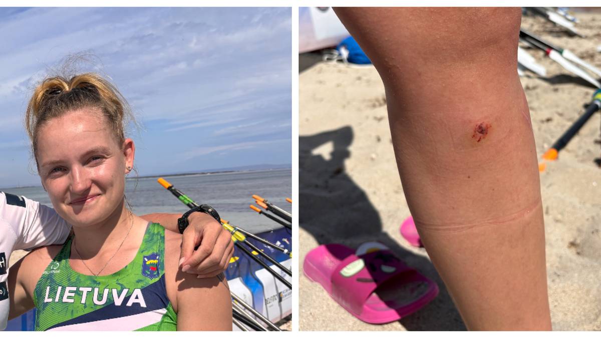 Roeren fryktet rabies etter hundeangrep: – Tanna hadde kommet inn