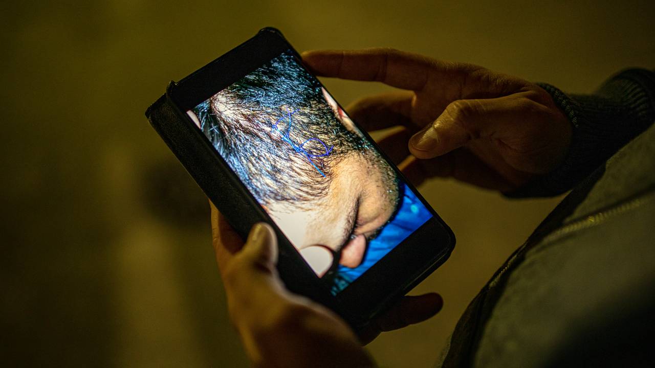 Bilete på mobilen - skade i hovudet