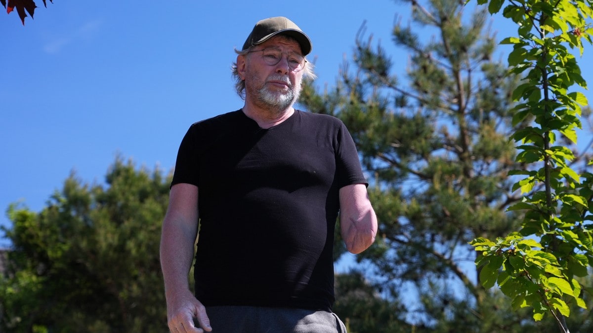 Freddy (63) skulle bare kappe ved – mistet armen