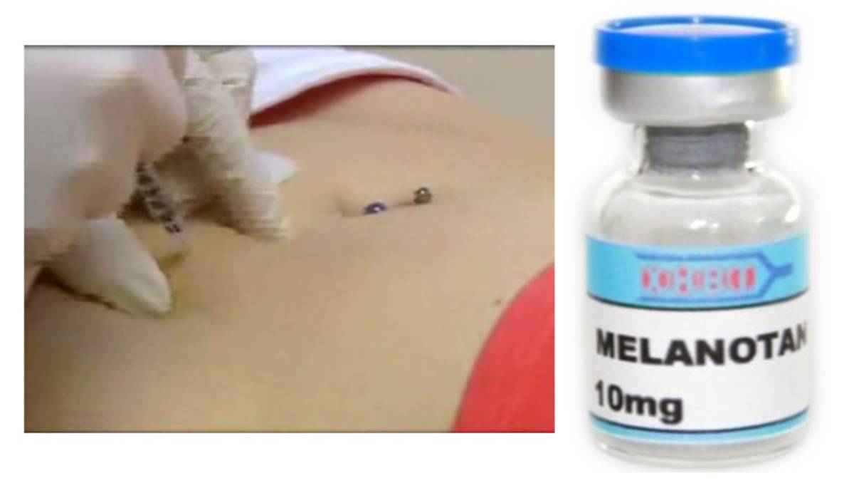 melanotan 2 order melanotan 2 purchase Melanotan 2