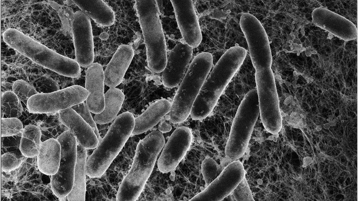 Disse ørsmå virusene gir håp i kampen mot økt antibiotikaresistens