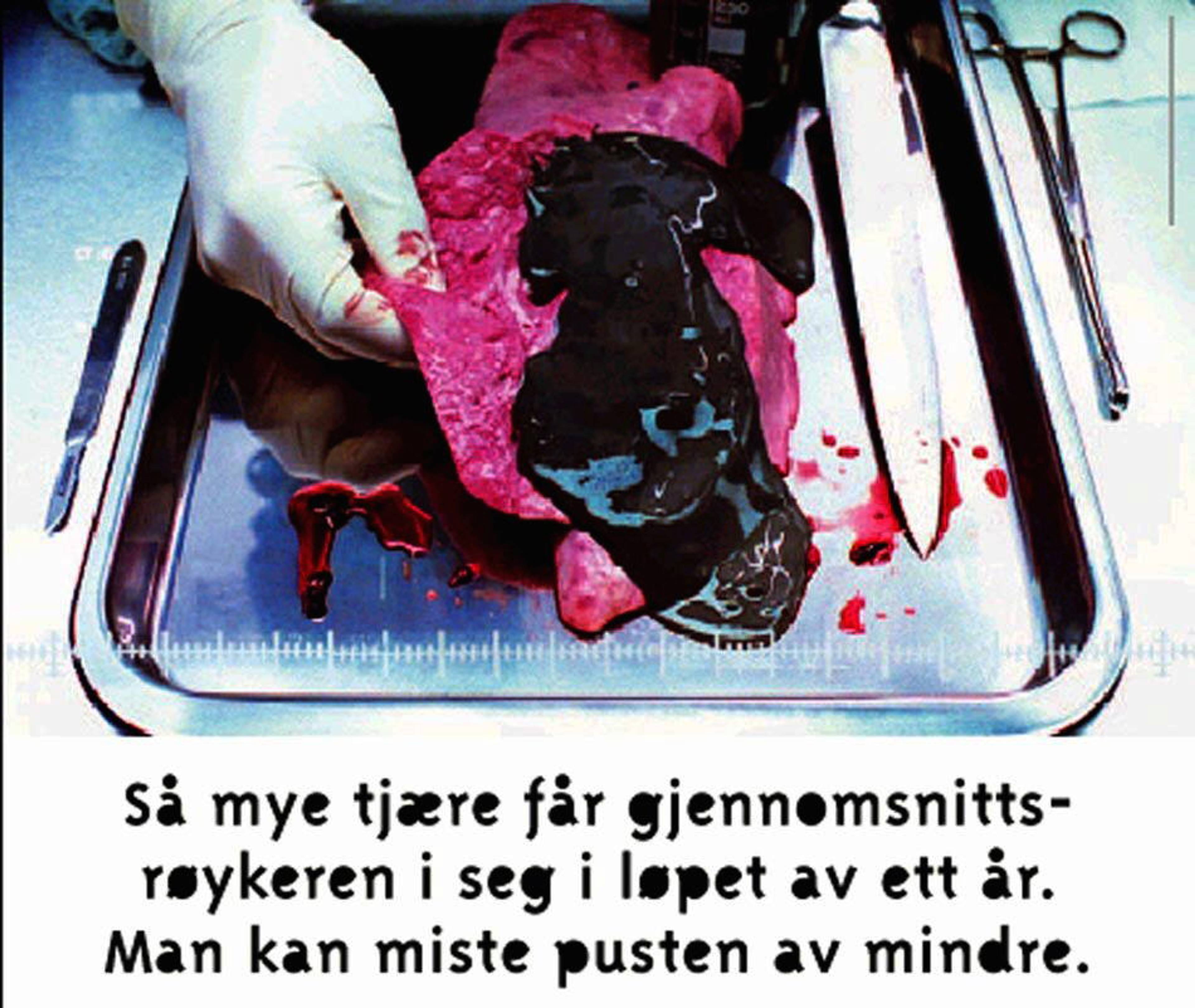 Helsedirektoratet kampanje