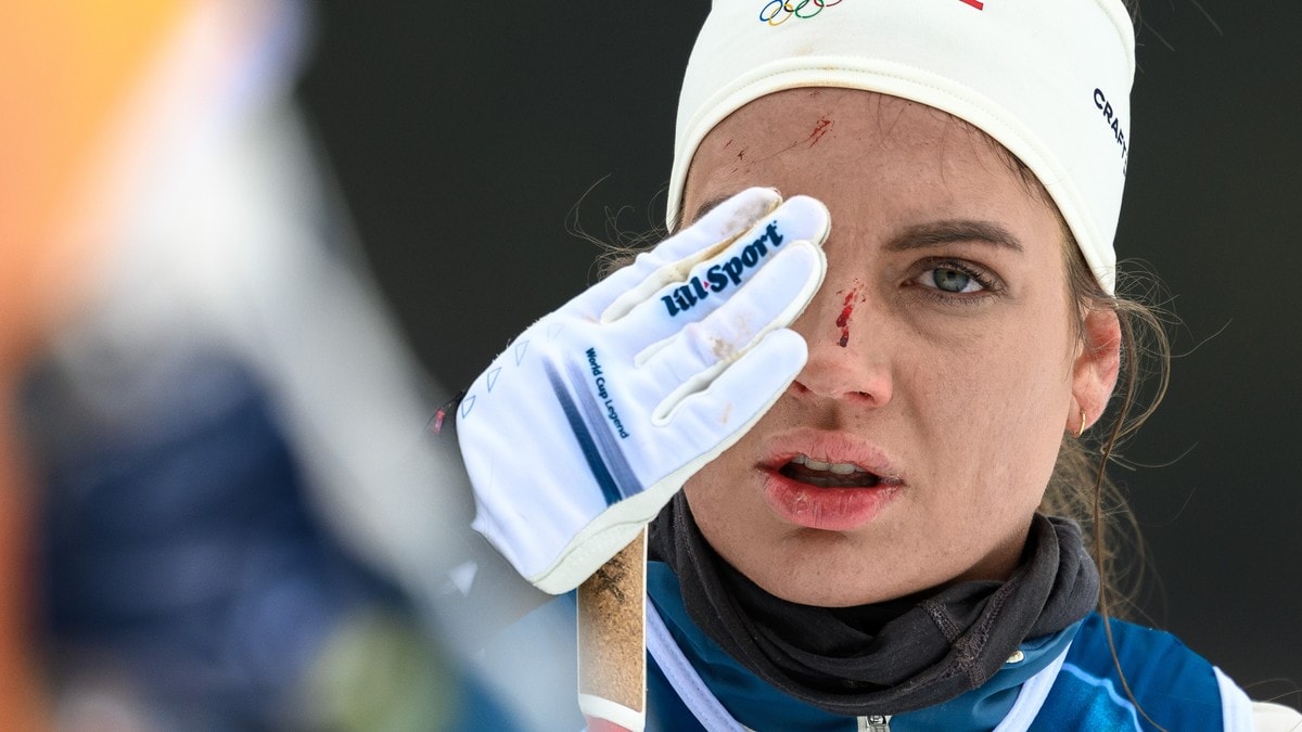 Skistad etter blodig treningsfall: – Jeg fikk en vekker