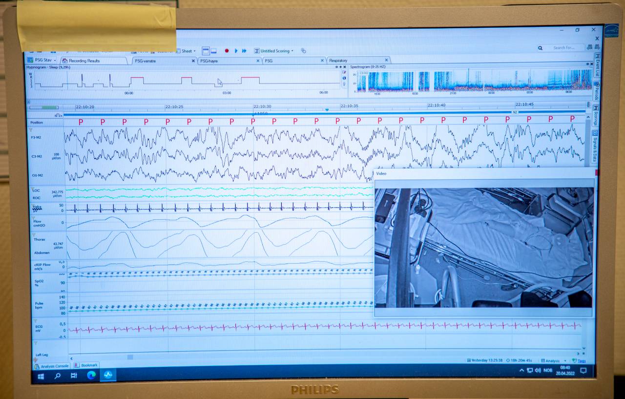 Tobias sin sømnanalyse. Det er ein skjerm som syner ein hel masse data i grafar -- puls, pust, rørsler og alt mogleg. Nederst på skjermen ser ein ein video av Tobias frå då han sov om natta.
