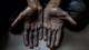 Altaf Qadri / AP,NTB Close-up of a person's dirty hands, palms facing upwards.
The hands appear to be covered in dark dirt or grime, suggesting manual labor or exposure to harsh conditions.
The background is dark and out of focus, drawing all attention to the hands.
The image conveys a sense of hard work and struggle. (Bildebeskrivelsen er laget av en KI-tjeneste)