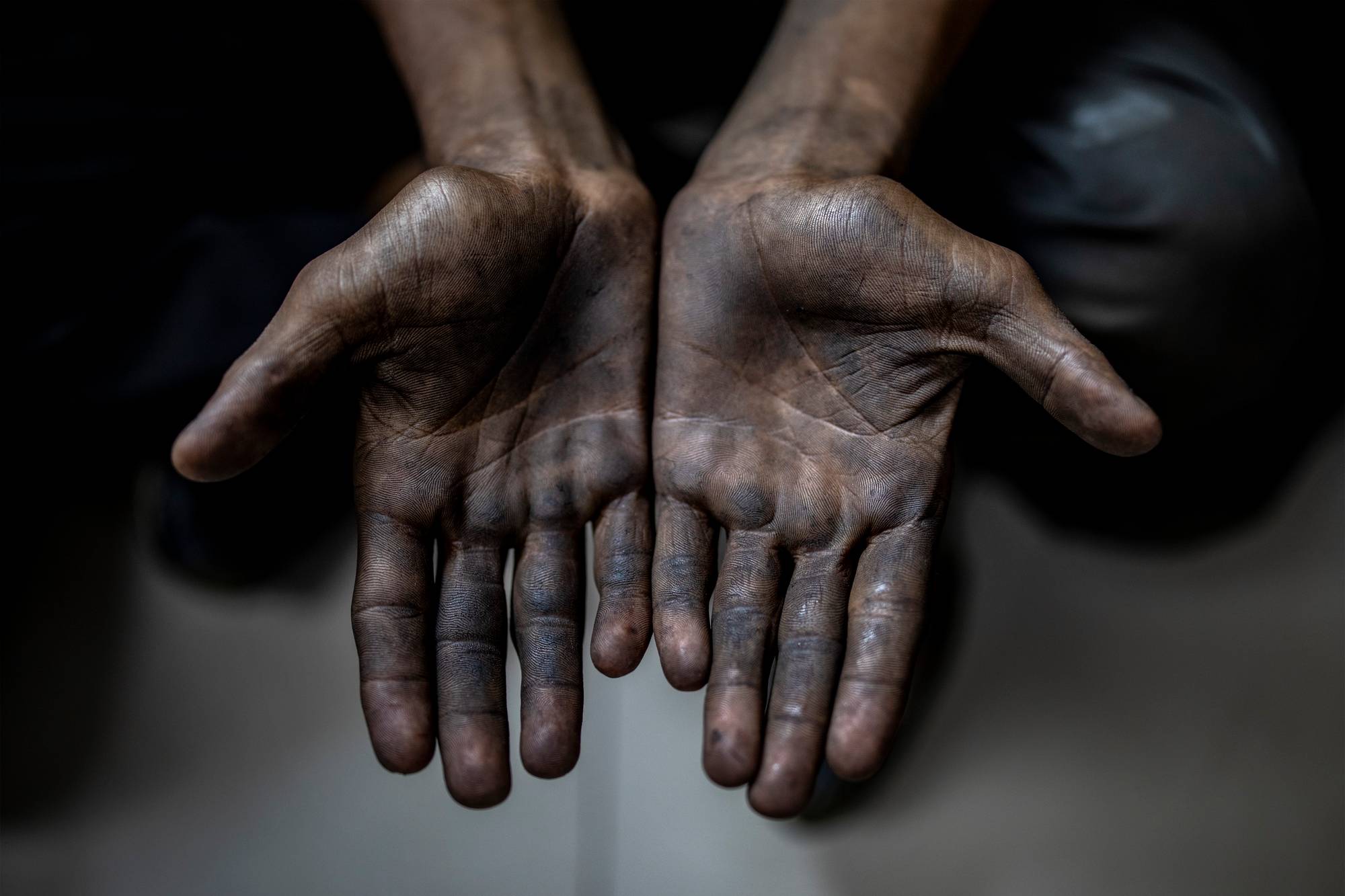 Close-up of a person's dirty hands, palms facing upwards.
The hands appear to be covered in dark dirt or grime, suggesting manual labor or exposure to harsh conditions.
The background is dark and out of focus, drawing all attention to the hands.
The image conveys a sense of hard work and struggle. (Bildebeskrivelsen er laget av en KI-tjeneste)
