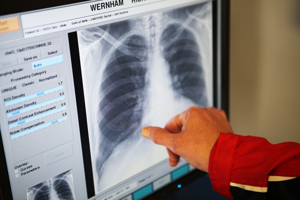 Helse Sør-Øst skrinlegger røntgenprosjekt – taper minst 220 millioner