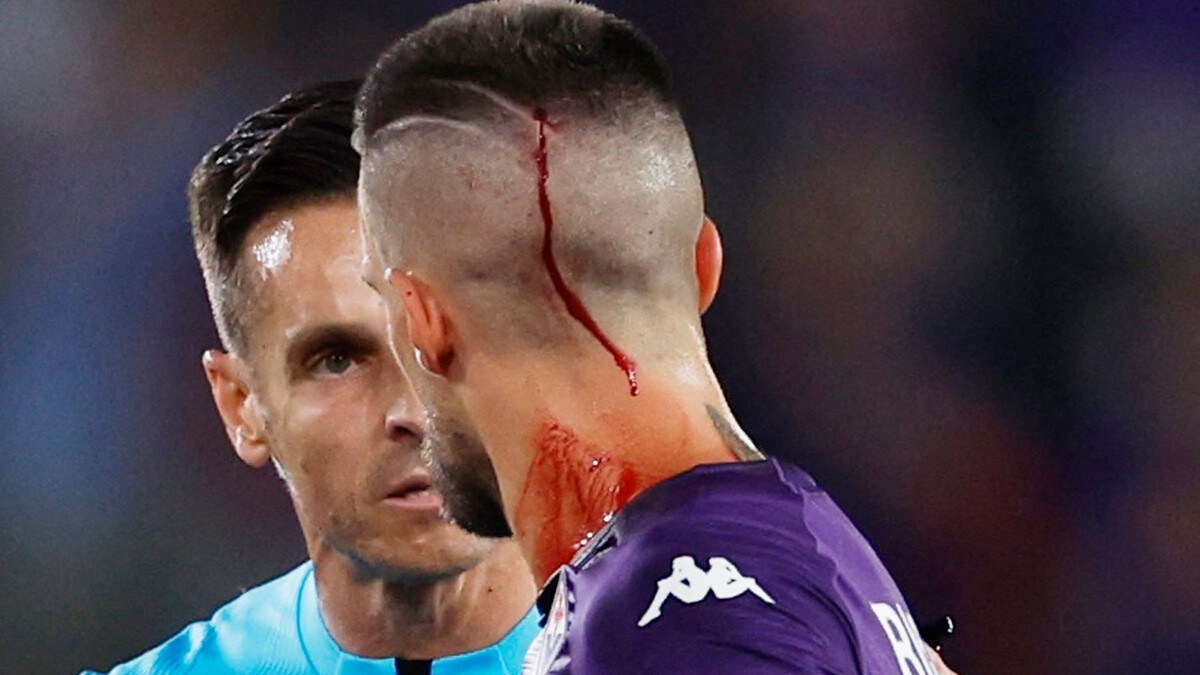 Blodige scener i serieliga-finalen: Fiorentina-spiller truffet av gjenstand