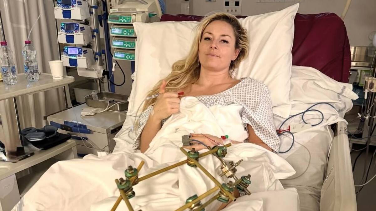 Vonn hjemme i USA etter OL-skaden: – Ikke stått på beina på over en uke